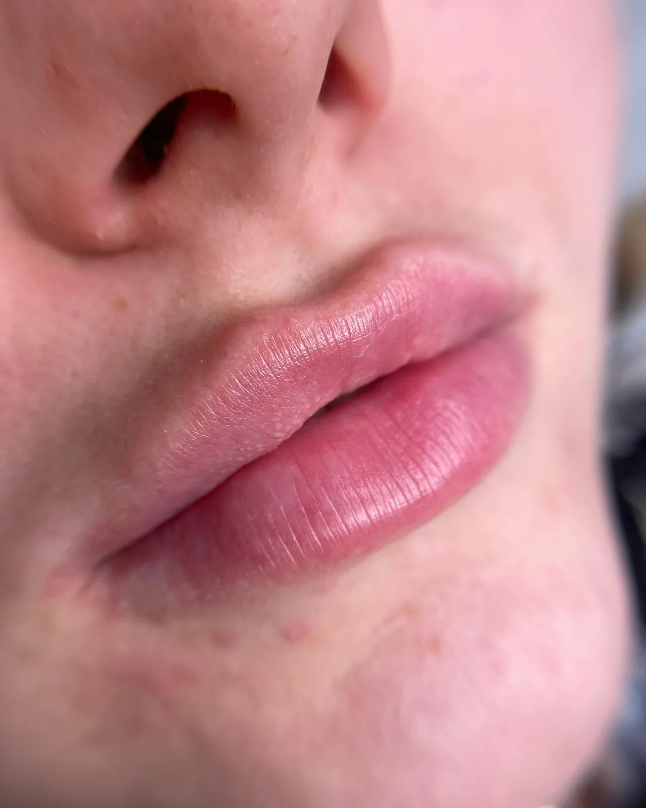 Lippen vor der Lippenpigmentierung